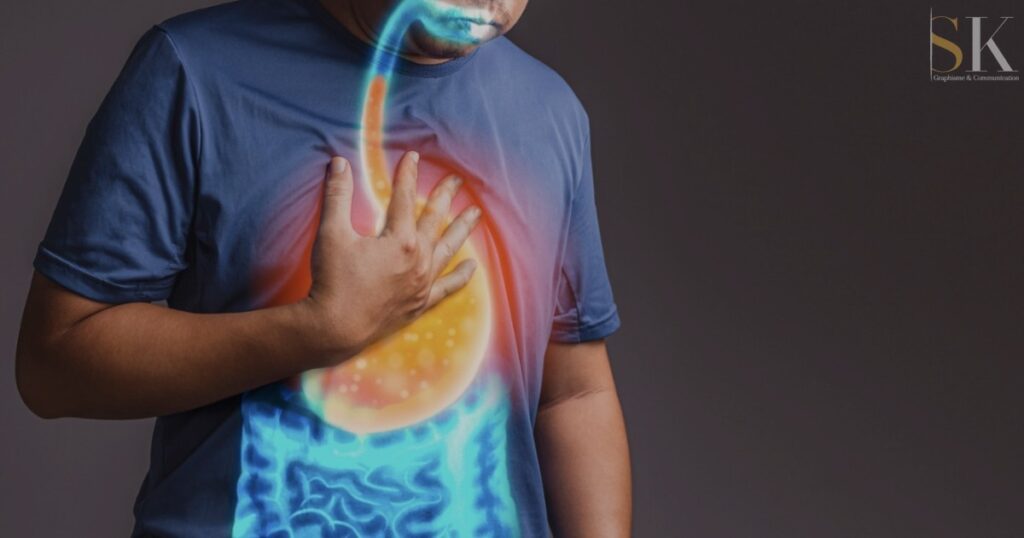 6 Cara Sederhana Kelola GERD Setelah Lebaran