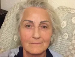 Dosen terus diejek rekannya soal kecacatan dan tuduhan rasis, menang gugatan £177.000