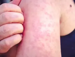 Kasus kelaparan di South Carolina melonjak jadi 646, Clemson waspadai wabah