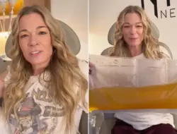 LeAnn Rimes habiskan $10.000 perbaiki gigi yang copot saat tampil