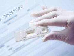 Rapid Test Antigen: Tak Satu Pun Warga Positif di Kerumunan Jokowi NTT