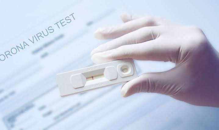 Rapid Test Antigen: Tak Satu Pun Warga Positif di Kerumunan Jokowi NTT