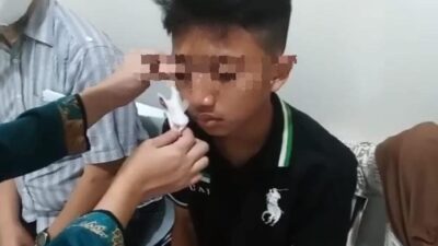 Mata Kanan Santri Tertancam Anak Panah karena Bercanda