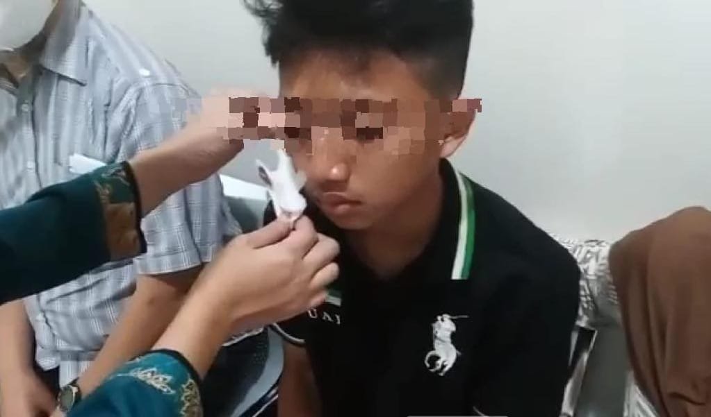 Mata Kanan Santri Tertancam Anak Panah karena Bercanda