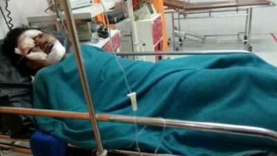 Korban Tabrakan Patah Tulang, Pengemudi AS Diduga Kebal Hukum