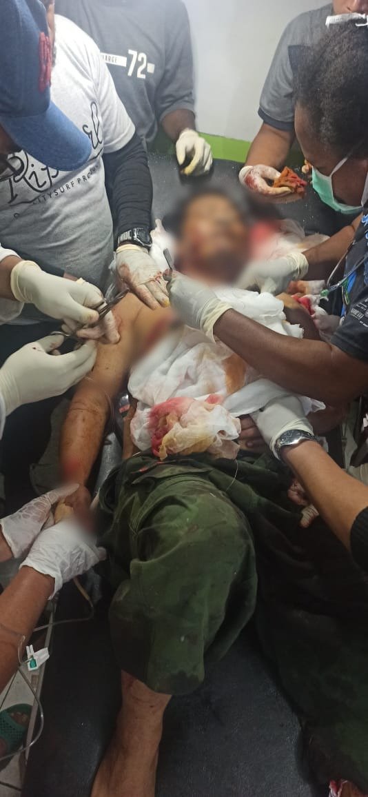 KKB Serang Penjual Bakso Keliling Sampai Kondisi Kritis