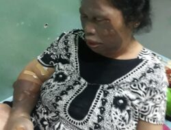 Tabung Elpigi 3 Kg Meledak, Dua Warga Jadi Korban