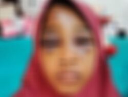 Disuruh Antar Menu Buka Puasa ke Rumah Nenek, Remaja Dianiaya Bapak Tiri Hingga Babak Belur