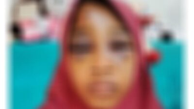 Disuruh Antar Menu Buka Puasa ke Rumah Nenek, Remaja Dianiaya Bapak Tiri Hingga Babak Belur