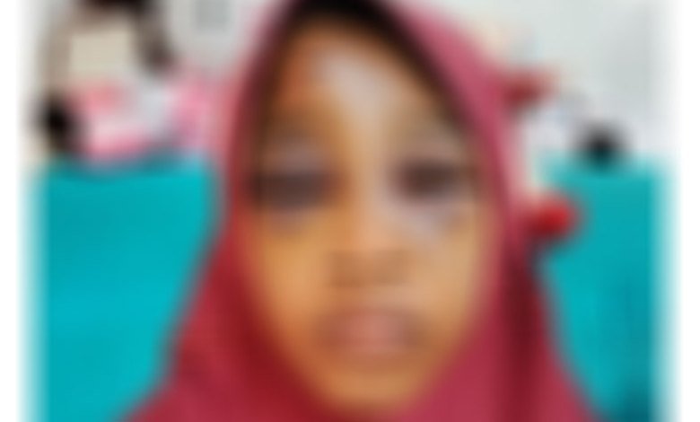 Disuruh Antar Menu Buka Puasa ke Rumah Nenek, Remaja Dianiaya Bapak Tiri Hingga Babak Belur