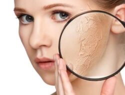 3 Bahan Alami Ampuh Atasi Kulit Kering