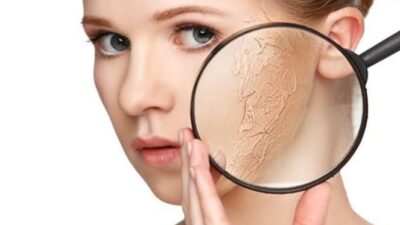 3 Bahan Alami Ampuh Atasi Kulit Kering