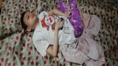 Hak Penyandang Disabilitas di Pandeglang Masih Terabaikan