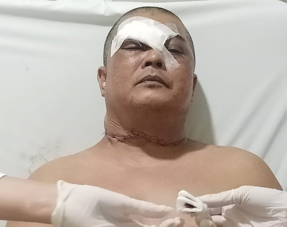 Korban Percobaan Pembunuhan di Depok Harap Pelaku Dihukum Maksimal