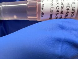 Dia telah melakukan penelitian yang sangat mendalam dan tidak dapat dihindari, tetapi dia telah melakukan beberapa penelitian yang menunjukkan bahwa penelitian pada hewan telah memperlambat kemajuan medis.