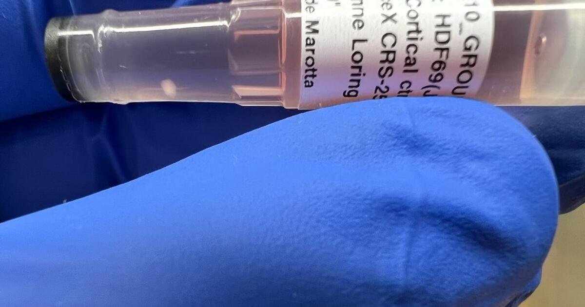 Dia telah melakukan penelitian yang sangat mendalam dan tidak dapat dihindari, tetapi dia telah melakukan beberapa penelitian yang menunjukkan bahwa penelitian pada hewan telah memperlambat kemajuan medis.